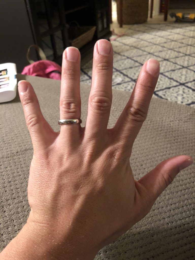 Losing My Wedding Ring Don't Blink